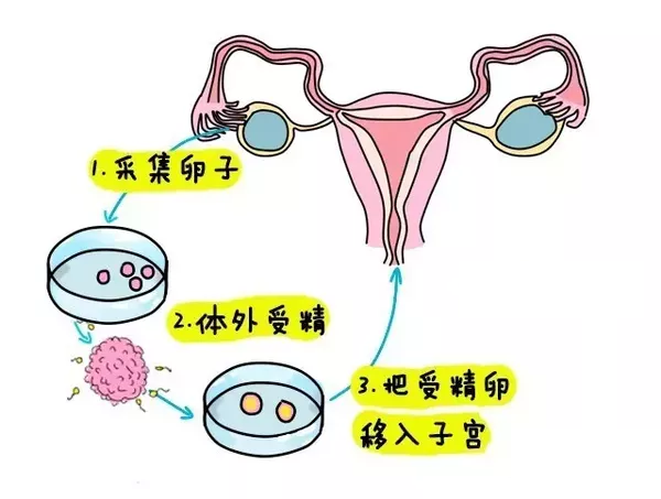 高薪捐卵女生